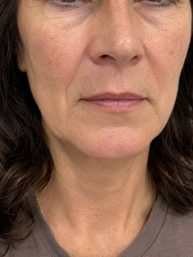 Gesicht, Mund- und Kinnpartie – vorher
